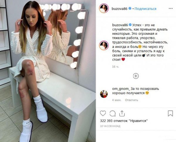 Трудный путь к успеху: Ольга Бузова опубликовала фото с разбитыми коленями Всячина