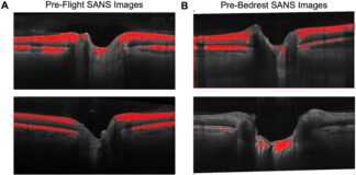 Новий інструмент штучного інтелекту передбачає ризик втрати зору астронавтів перед запуском