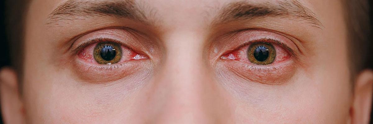 Заказать линзы для зрения Киев - Магазин контактных линз Linzomat.UA