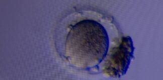 Nova tecnologia aumenta as taxas de recuperação de óvulos no tratamento de fertilidade