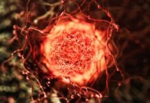 Anti-Aging-Nahrungsergänzungsmittel im Zusammenhang mit Krebswachstum: Neue Forschungsergebnisse enthüllen kritischen Mechanismus