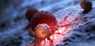 Capovolgi l’interruttore: gli scienziati hanno scoperto come impedire alle cellule T CAR di arrendersi