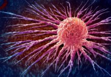 Detener el cáncer de próstata en seco